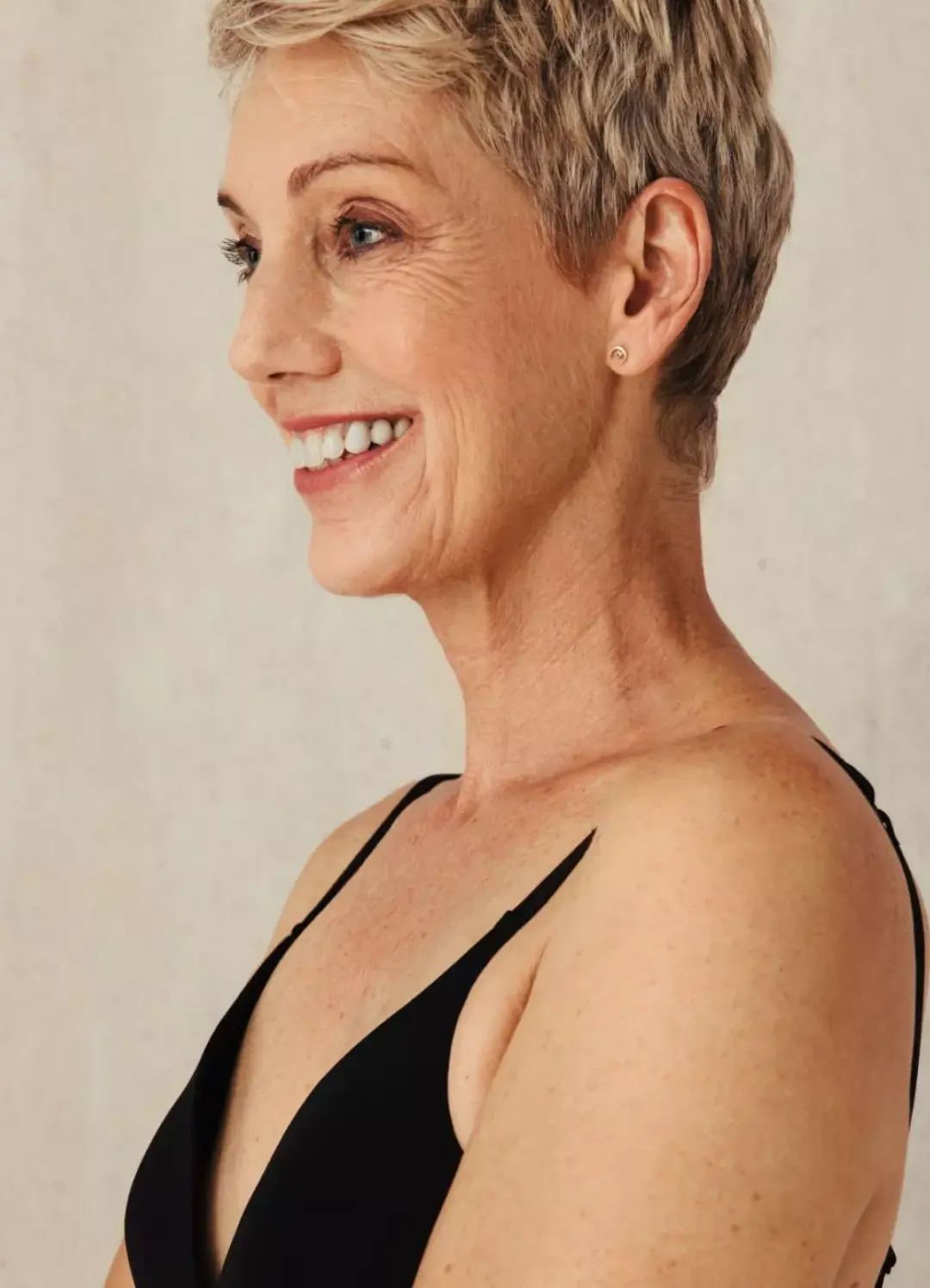 clarity for dense breasts